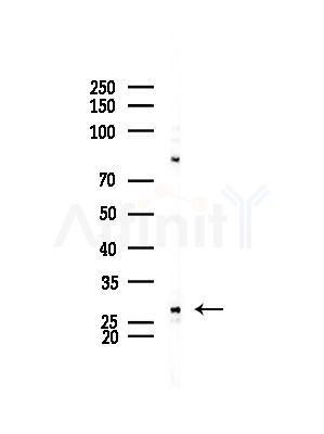 RAB26 Antibody - Western blot analysis of lysates from HepG2 cells(LPS,4h treatment), using RAB26 Antibody at 1/1000 dilution.