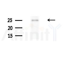 RAB2B Antibody - Western blot analysis of extracts from Raji cells(heat-shock,45min treatment), using RAB2B Antibody at 1/1000 dilution.