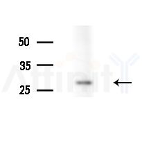 RAB2B Antibody - Western blot analysis of extracts from Rat liver, using RAB2B Antibody at 1/1000 dilution.