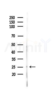 RAB2B Antibody - Western blot analysis of lysates from Rat liver, using RAB2B Antibody at 1/1000 dilution.