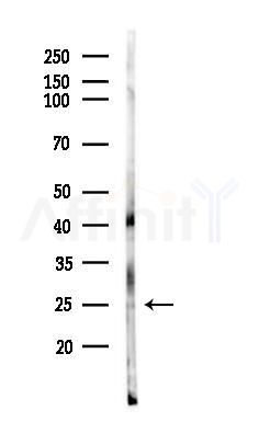 RAB2B Antibody - Western blot analysis of lysates from Raji cells(heat-shock,45min treatment), using RAB2B Antibody at 1/1000 dilution.