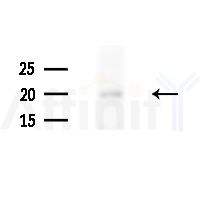 RAB31 Antibody - Western blot analysis of lysates from Raji cells(heat-shock,45min treatment), using RAB31 Antibody at 1/1000 dilution.