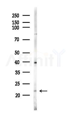 RAB31 Antibody - Western blot analysis of lysates from Raji cells(heat-shock,45min treatment), using RAB31 Antibody at 1/1000 dilution.