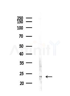 RAB37 Antibody - Western blot analysis of lysates from EC304 cells(heat-shock,45min treatment), using RAB37 Antibody at 1/1000 dilution.