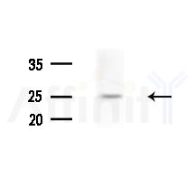 RAB38 Antibody - Western blot analysis of extracts from Mouse brain, using RAB38 Antibody at 1/1000 dilution.