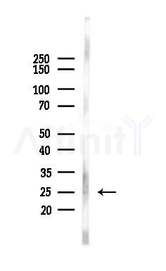 RAB38 Antibody - Western blot analysis of lysates from Mouse brain, using RAB38 Antibody at 1/1000 dilution.