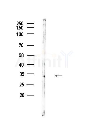 RAB40B Antibody - Western blot analysis of lysates from HUVEC cells, using RAB40B Antibody at 1/1000 dilution.