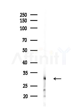 RAB5C Antibody - Western blot analysis of lysates from MDA-MB-231 cells(heat-shock,45min treatment), using RAB5C Antibody at 1/1000 dilution.