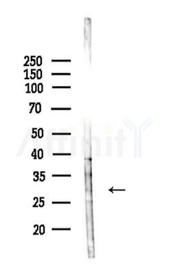 RAB6C Antibody - Western blot analysis of lysates from Mouse liver, using RAB6C Antibody at 1/1000 dilution.