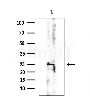 RAB7L1 Antibody - Western blot analysis of extracts from Mouse brain, using RAB7L1 Antibody at 1/1000 dilution.