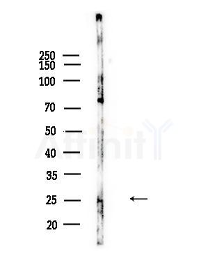 RAB7L1 Antibody - Western blot analysis of lysates from Mouse brain, using RAB7L1 Antibody at 1/1000 dilution.