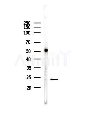 RGS1 Antibody - Western blot analysis of lysates from PC12 cells, using RGS1 Antibody at 1/1000 dilution.