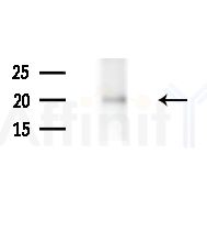 RGS10 Antibody - Western blot analysis of extracts from HepG2 cells(starvation,24h treatment), using RGS10 Antibody at 1/1000 dilution.