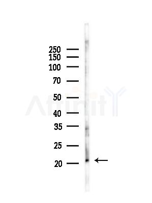 RGS5 Antibody - Western blot analysis of lysates from RAW264.