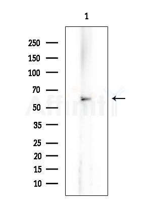 RGS7 Antibody - Western blot analysis of extracts from HUVEC cells, using RGS7 Antibody at 1/1000 dilution.