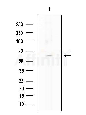 RGS7 Antibody - Western blot analysis of extracts from COLO205 cells, using RGS7 Antibody at 1/1000 dilution.