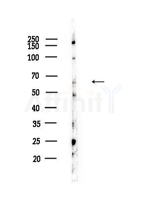 RGS7 Antibody - Western blot analysis of lysates from HUVEC cells, using RGS7 Antibody at 1/1000 dilution.