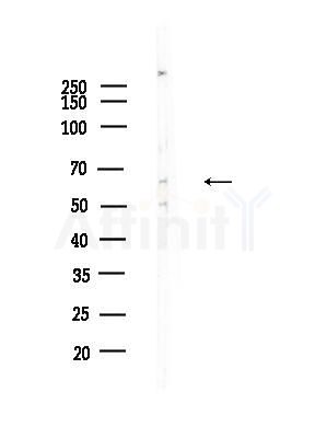 RGS7 Antibody - Western blot analysis of lysates from COLO205 cells, using RGS7 Antibody at 1/1000 dilution.