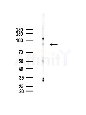 RPTN Antibody - Western blot analysis of lysates from EC304 cells, using RPTN Antibody at 1/1000 dilution.