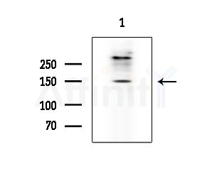 ARHGEF10 Antibody - Western blot analysis of extracts from A375 cells(starvation treatment), using ARHGEF10 Antibody at 1/1000 dilution.