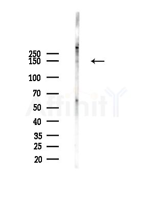 ARHGEF10 Antibody - Western blot analysis of lysates from A375 cells(starvation,24h treatment), using ARHGEF10 Antibody at 1/1000 dilution.