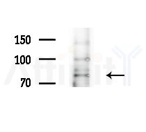 ARHGEF16 Antibody - Western blot analysis of extracts from HepG2 cells(LPS 4h treatment), using ARHGEF16 Antibody at 1/1000 dilution.
