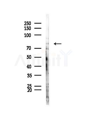 ARHGEF16 Antibody - Western blot analysis of lysates from HepG2 cells(LPS,4h treatment), using ARHGEF16 Antibody at 1/1000 dilution.