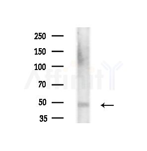 ARHGEF3 Antibody - Western blot analysis of extracts from COLO205 cells(heat-shock,45min treatment), using ARHGEF3 Antibody at 1/1000 dilution.