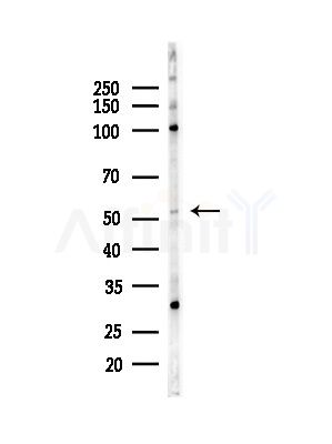 ARHGEF5 Antibody - Western blot analysis of lysates from HepG2 cells(LPS,4h treatment), using ARHGEF5 Antibody at 1/1000 dilution.