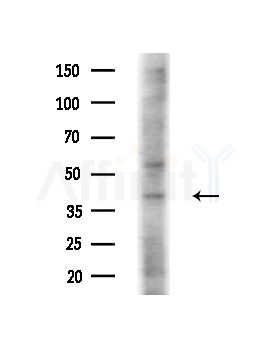 RRS1 Antibody - Western blot analysis of extracts from COLO205 cells(heat-shock,45min treatment), using RRS1 Antibody at 1/1000 dilution.