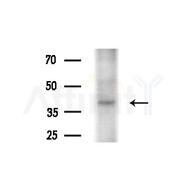 RRS1 Antibody - Western blot analysis of extracts from HUVEC cells(starvation,24h treatment), using RRS1 Antibody at 1/1000 dilution.