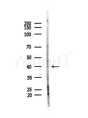 RRS1 Antibody - Western blot analysis of lysates from COLO205 cells(heat-shock,45min treatment), using RRS1 Antibody at 1/1000 dilution.