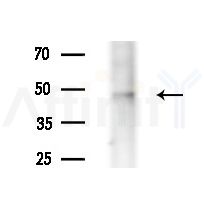 RNUXA Antibody - Western blot analysis of extracts from HepG2 cells(LPS 4h treatment), using RNUXA Antibody at 1/1000 dilution.
