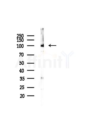 ATP2A1 Antibody - Western blot analysis of lysates from Hela cells(starvation,24h treatment), using ATP2A1 Antibody at 1/1000 dilution.