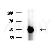 SEPT14 Antibody - Western blot analysis of extracts from HepG2 cells(LPS 4h treatment), using SEPT14 Antibody at 1/1000 dilution.