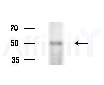 SEPT14 Antibody - Western blot analysis of extracts from PC12 cells(starvation treatment), using SEPT14 Antibody at 1/1000 dilution.