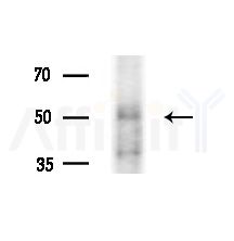 SEPT14 Antibody - Western blot analysis of extracts from Rat brain, using SEPT14 Antibody at 1/1000 dilution.