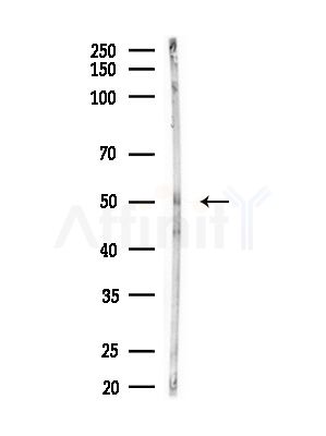 SEPT14 Antibody - Western blot analysis of lysates from Rat brain, using SEPT14 Antibody at 1/1000 dilution.