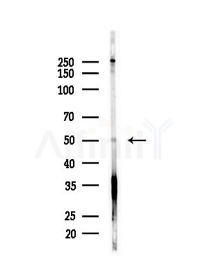 SEPT14 Antibody - Western blot analysis of lysates from PC12 cells(starvation,24h treatment), using SEPT14 Antibody at 1/1000 dilution.