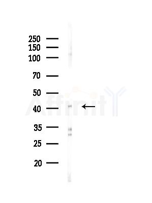 SEPT2 Antibody - Western blot analysis of lysates from A375 cells(LPS, 4h treatment), using SEPT2 Antibody at 1/1000 dilution.
