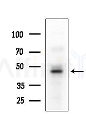 SEPT6 Antibody - Western blot analysis of extracts from Hela cells(heat-shock,45min treatment), using SEPT6 Antibody at 1/1000 dilution.