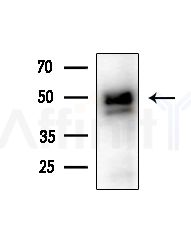 SEPT6 Antibody - Western blot analysis of extracts from Hela cells(heat-shock,45min treatment), using SEPT6 Antibody at 1/1000 dilution.