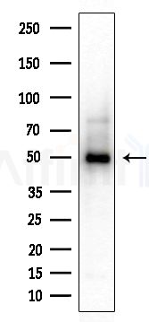 SEPT6 Antibody - Western blot analysis of extracts from Rat brain, using SEPT6 Antibody at 1/1000 dilution.
