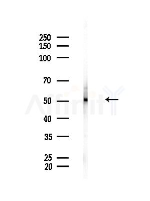 SEPT6 Antibody - Western blot analysis of lysates from Rat brain, using SEPT6 Antibody at 1/1000 dilution.