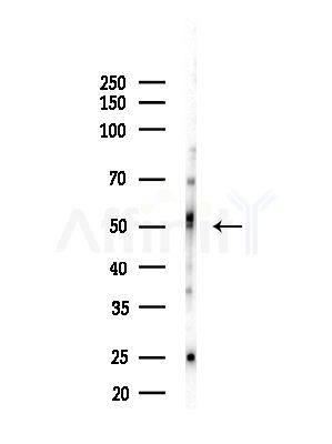 SEPT6 Antibody - Western blot analysis of lysates from Hela cells(heat-shock,45min treatment), using SEPT6 Antibody at 1/1000 dilution.
