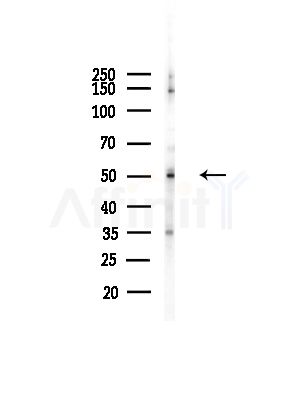 SEPT6 Antibody - Western blot analysis of lysates from Hela cells(heat-shock,45min treatment), using SEPT6 Antibody at 1/1000 dilution.