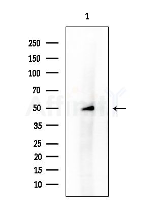 STK32C Antibody - Western blot analysis of extracts from HUVEC cells, using STK32C Antibody at 1/1000 dilution.
