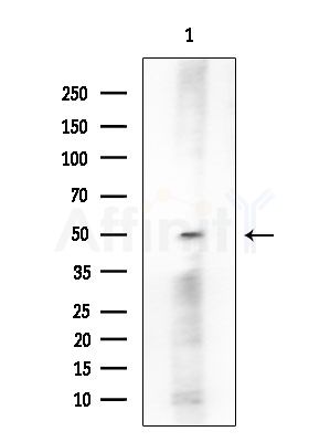STK32C Antibody - Western blot analysis of extracts from COLO205 cells, using STK32C Antibody at 1/1000 dilution.
