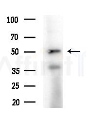 NIM1 Antibody - Western blot analysis of extracts from B16F10-LUC cells(starvation,24h treatment), using NIM1 Antibody at 1/1000 dilution.