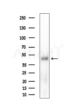NIM1 Antibody - Western blot analysis of extracts from Hela cells(heat-shock,45min treatment), using NIM1 Antibody at 1/1000 dilution.
